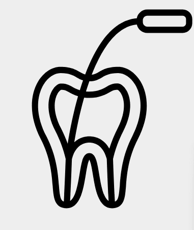Root Canal Therapy