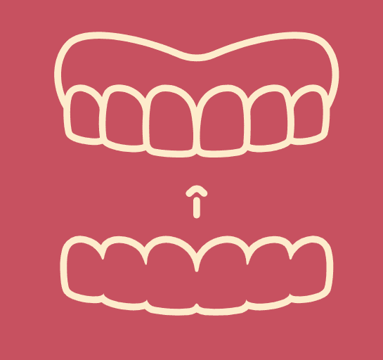 Simple graphic of upper and lower teeth