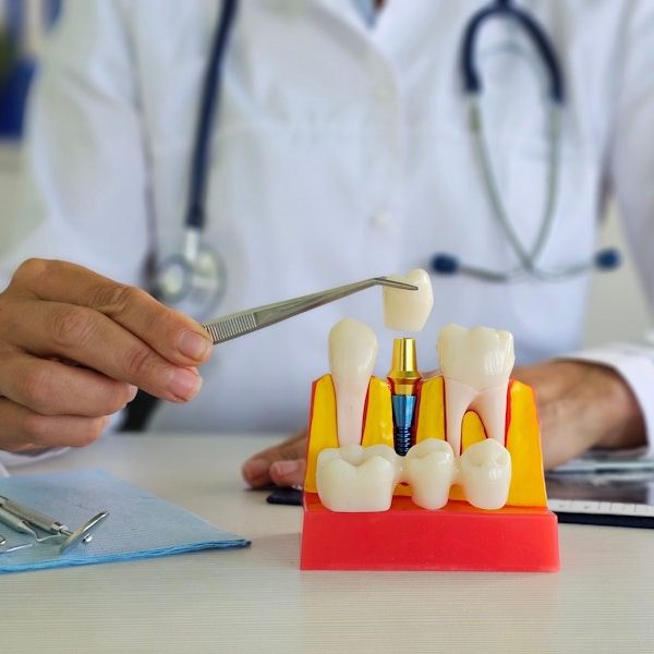 Doctor explaining tooth structure with model