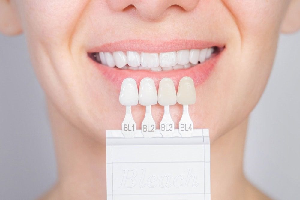 Teeth whitening shade comparison