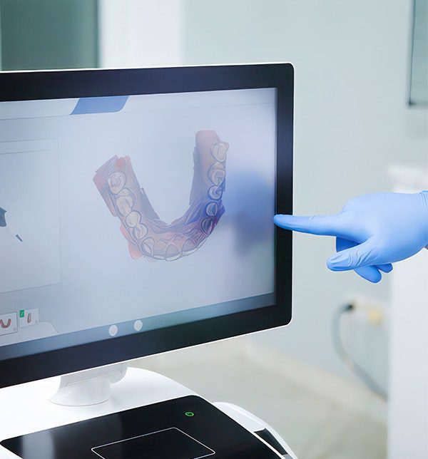 3D dental imaging on monitor