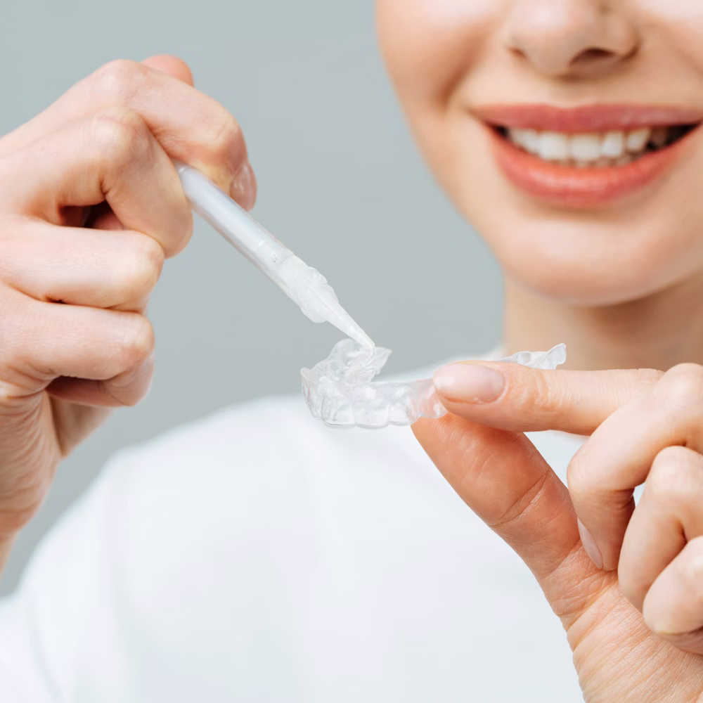 Smiling woman using teeth whitening kit