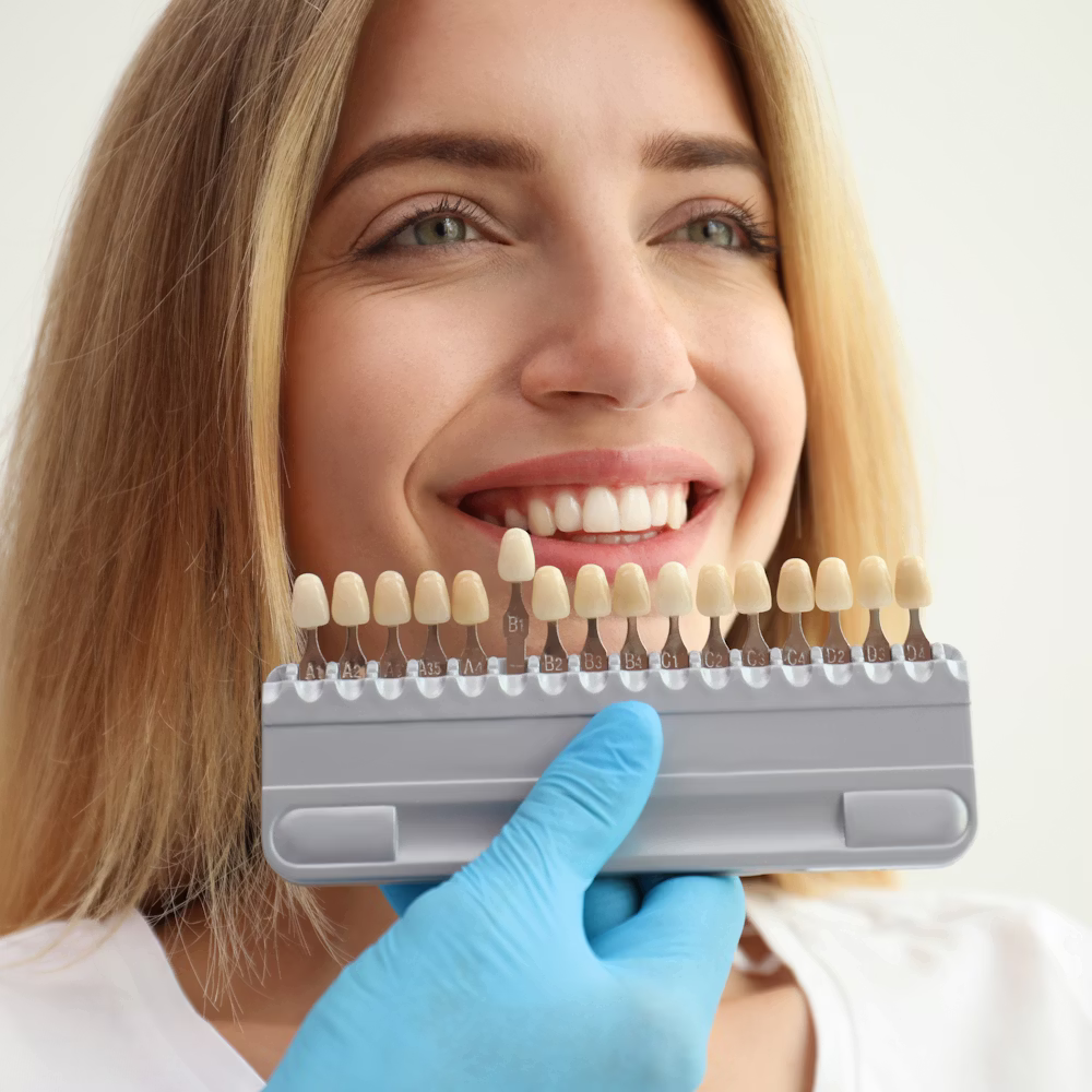Woman holding dental shade guide