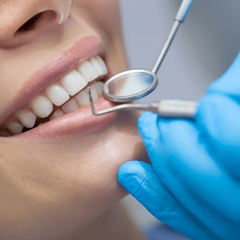 Dental check-up with mirror tool